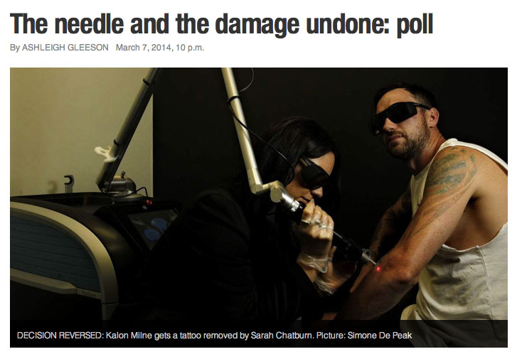 Newcastle Tattoo Removal - newcastle-herald